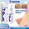 Say Goodbye to Discolored Nails with Jaysuing™ Nail Fungus Spray