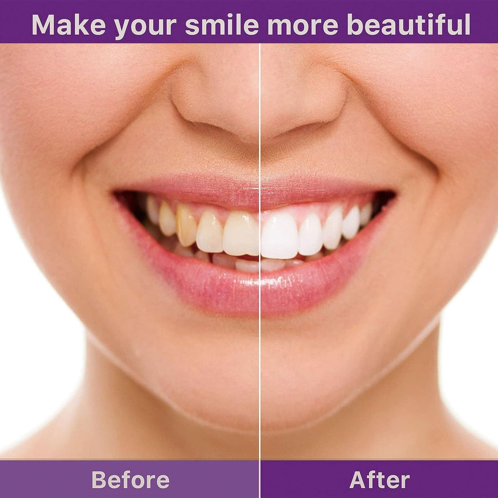 🦷 ✨ Smile Instantly with Hismile V34 Teeth Brightening Serum 💜