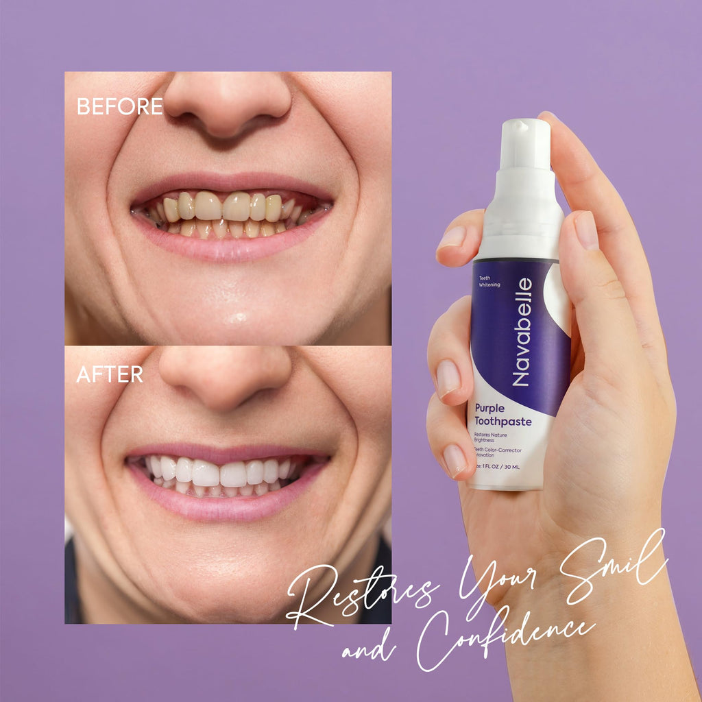 🦷 ✨ Smile Instantly with Hismile V34 Teeth Brightening Serum 💜