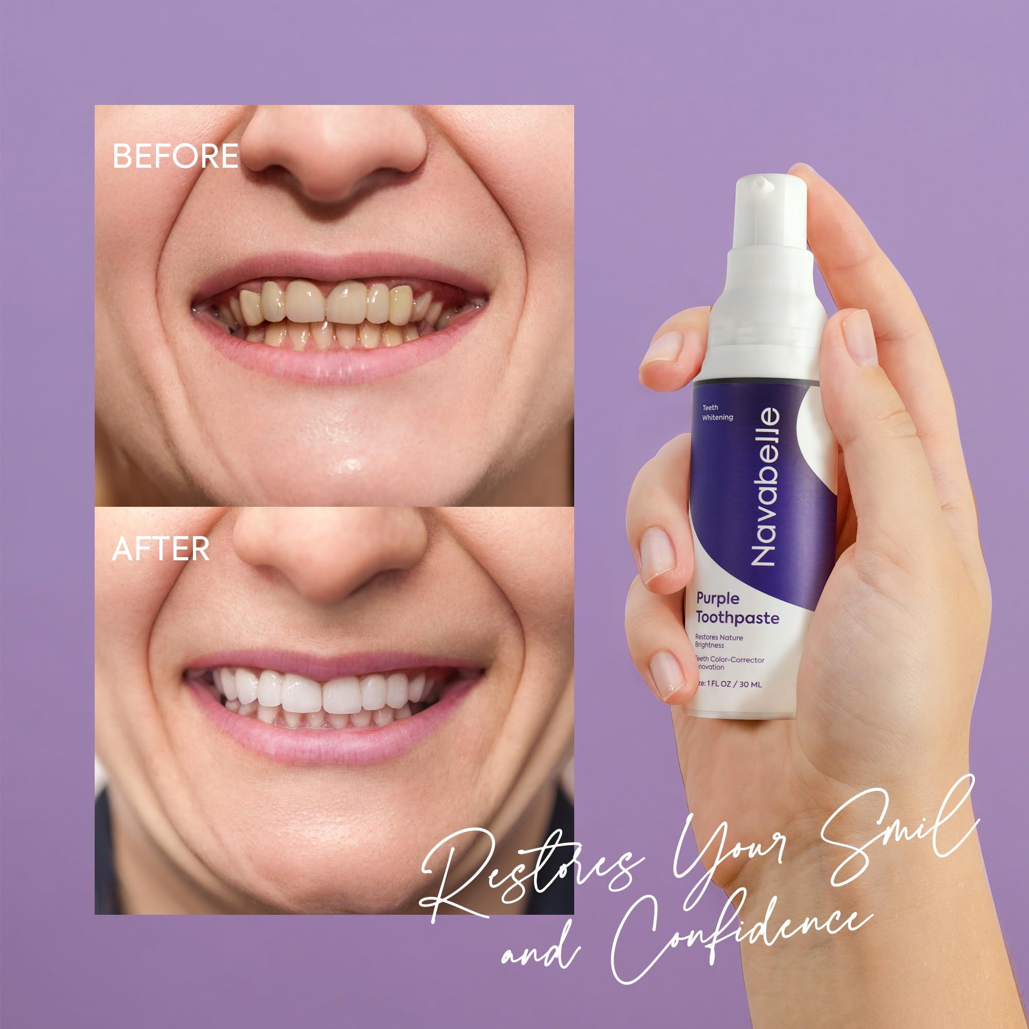🦷 ✨ Smile Instantly with Hismile V34 Teeth Brightening Serum 💜