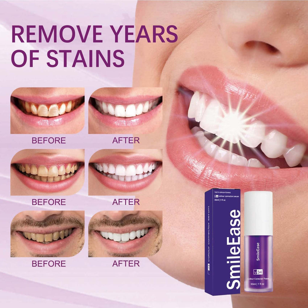 🦷 ✨ Smile Instantly with Hismile V34 Teeth Brightening Serum 💜