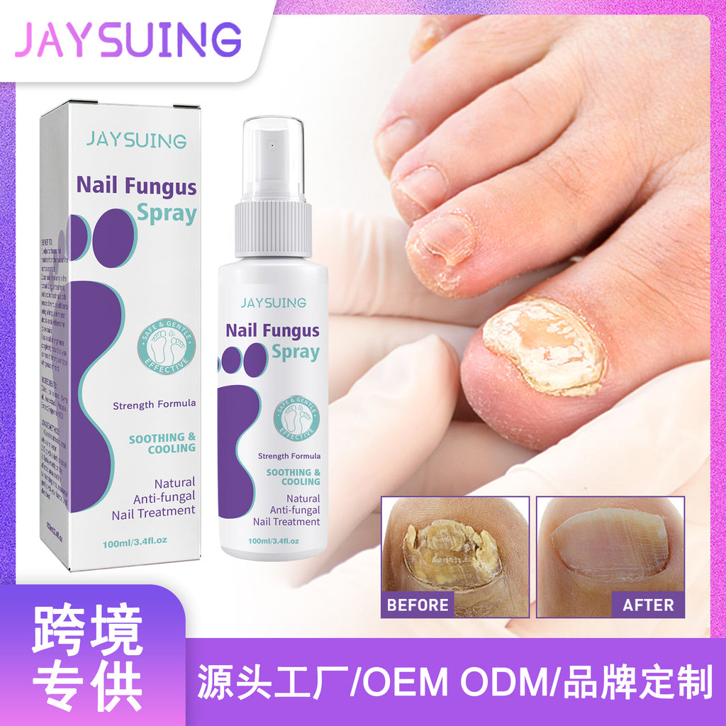 Say Goodbye to Discolored Nails with Jaysuing™ Nail Fungus Spray