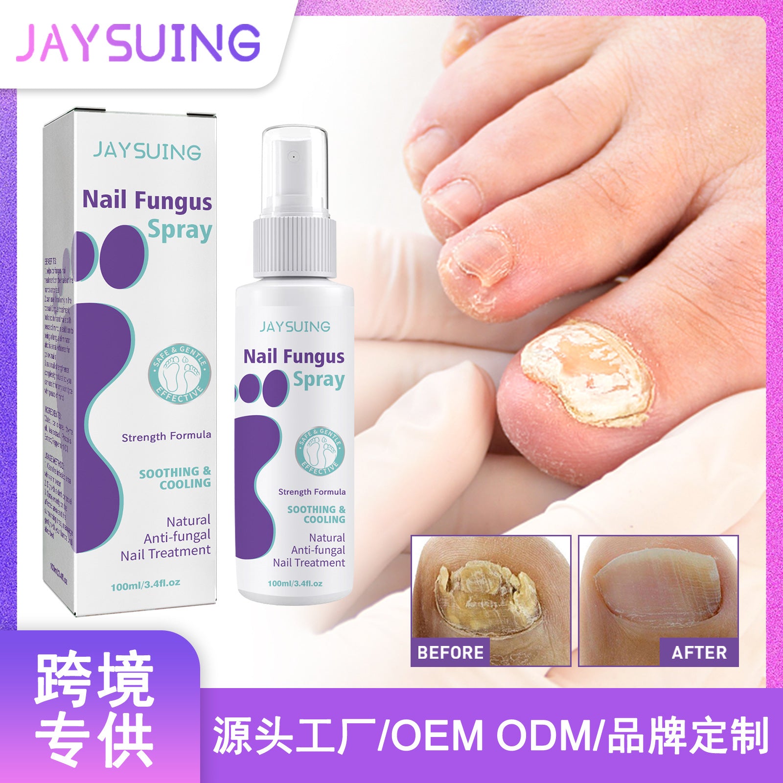 Say Goodbye to Discolored Nails with Jaysuing™ Nail Fungus Spray