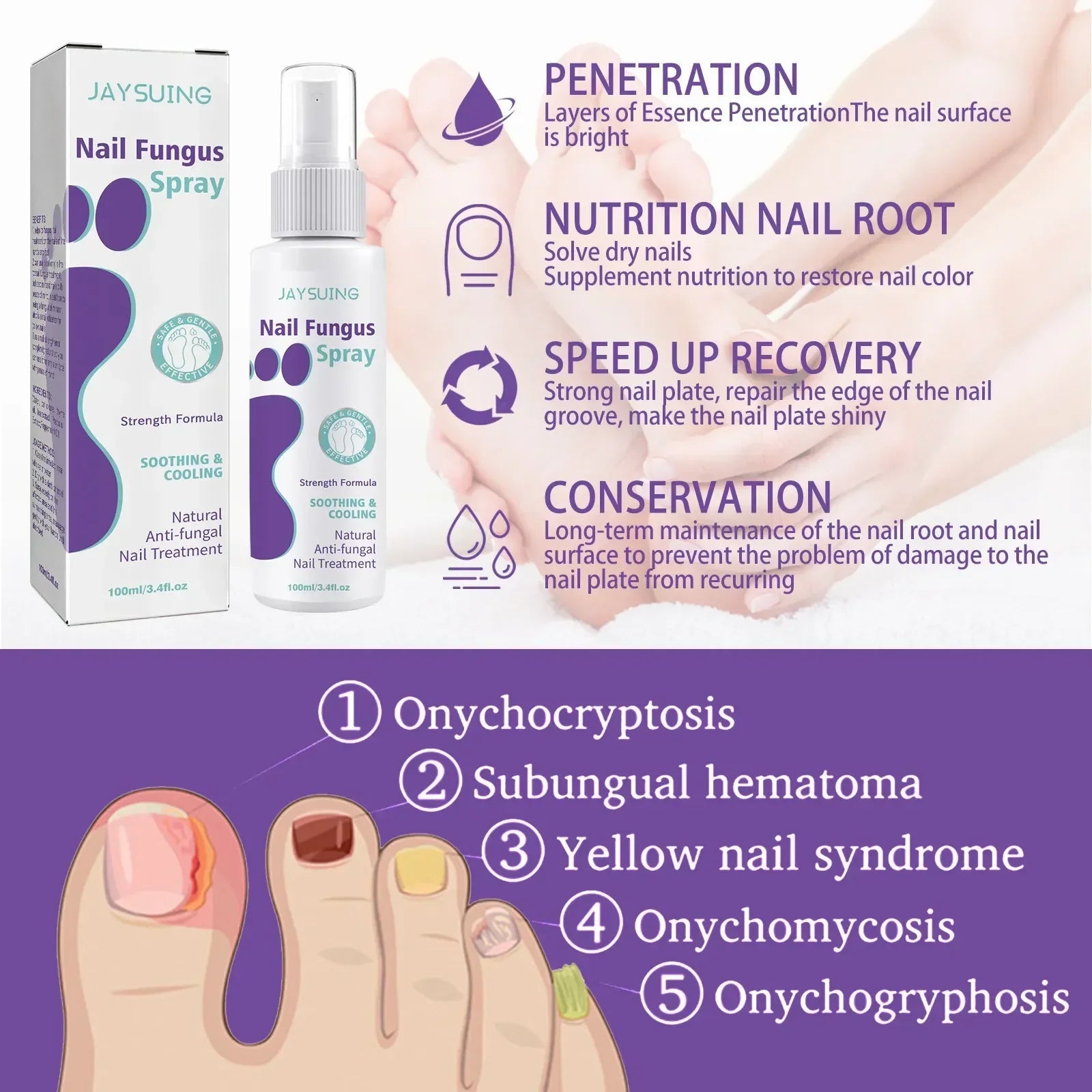 Say Goodbye to Discolored Nails with Jaysuing™ Nail Fungus Spray